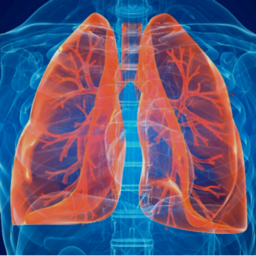 Pneumologia a Napoli: soluzioni per la tua salute respiratoria