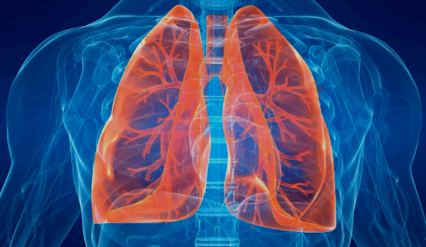 Pneumologia a Napoli: soluzioni per la tua salute respiratoria