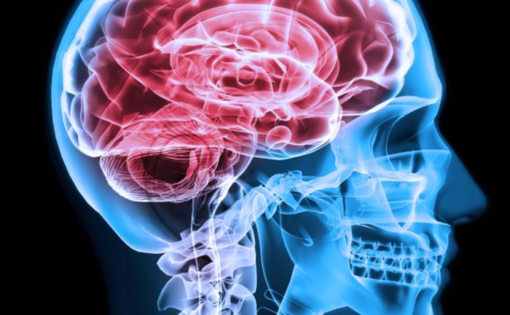 Neurologia a Napoli: specialisti al servizio della tua salute cerebrale