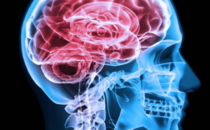 Neurologia a Napoli: specialisti al servizio della tua salute cerebrale