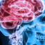 Neurologia a Napoli: specialisti al servizio della tua salute cerebrale