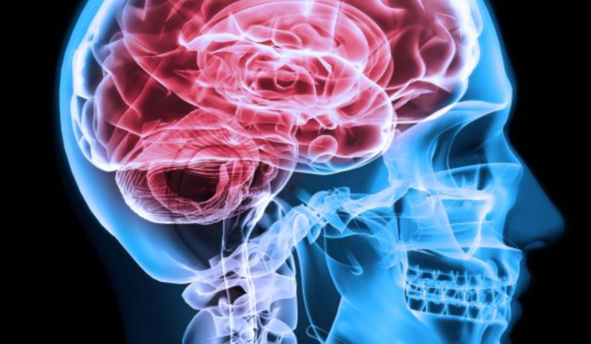 Medicina nucleare a Napoli: scintigrafie e diagnosi di precisione Medicina nucleare a Napoli: scintigrafie e diagnosi di precisione